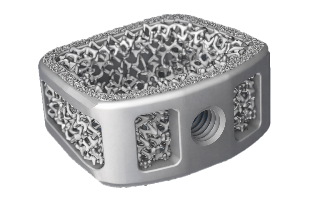 Silony Spine's FLX implant