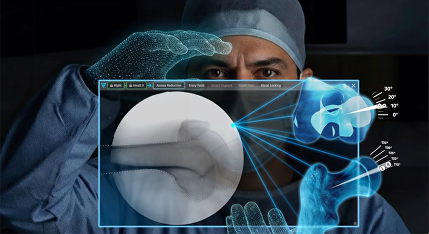 DePuy Synthes VELYS for Trauma