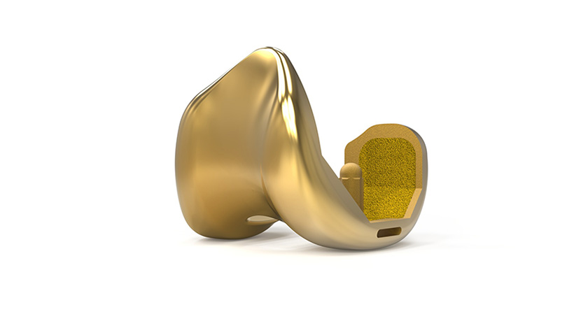 Stryker Triathlon Gold Implant