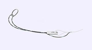Native Orthopaedics' Dragonfly Repair Construct