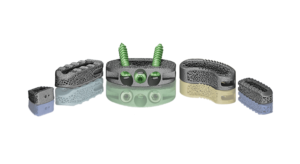SpineCraft Earns 510(k) for ORIO-3D Trabecular Interbody Platform