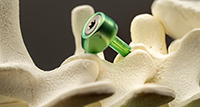 BoxSpine DUET System
