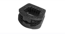 SpinePoint Flex-Z Cervical Cage.