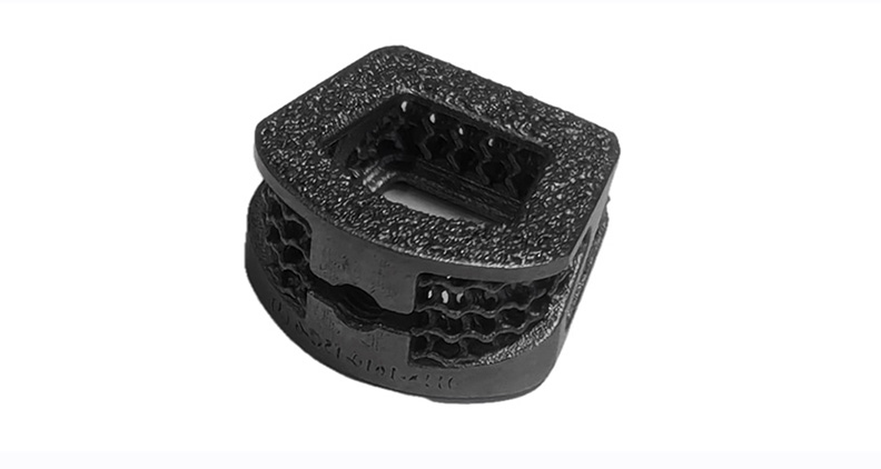 SpinePoint Flex-Z Cervical Cage.